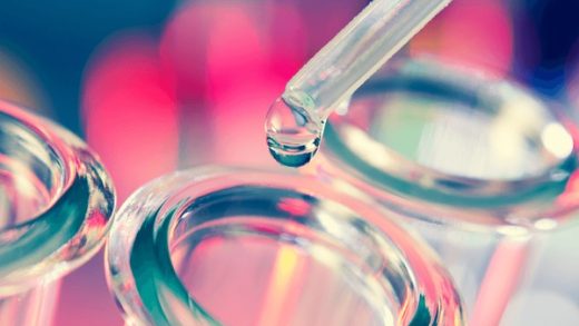 How Do You Remove Histamine From Your Body 520x293